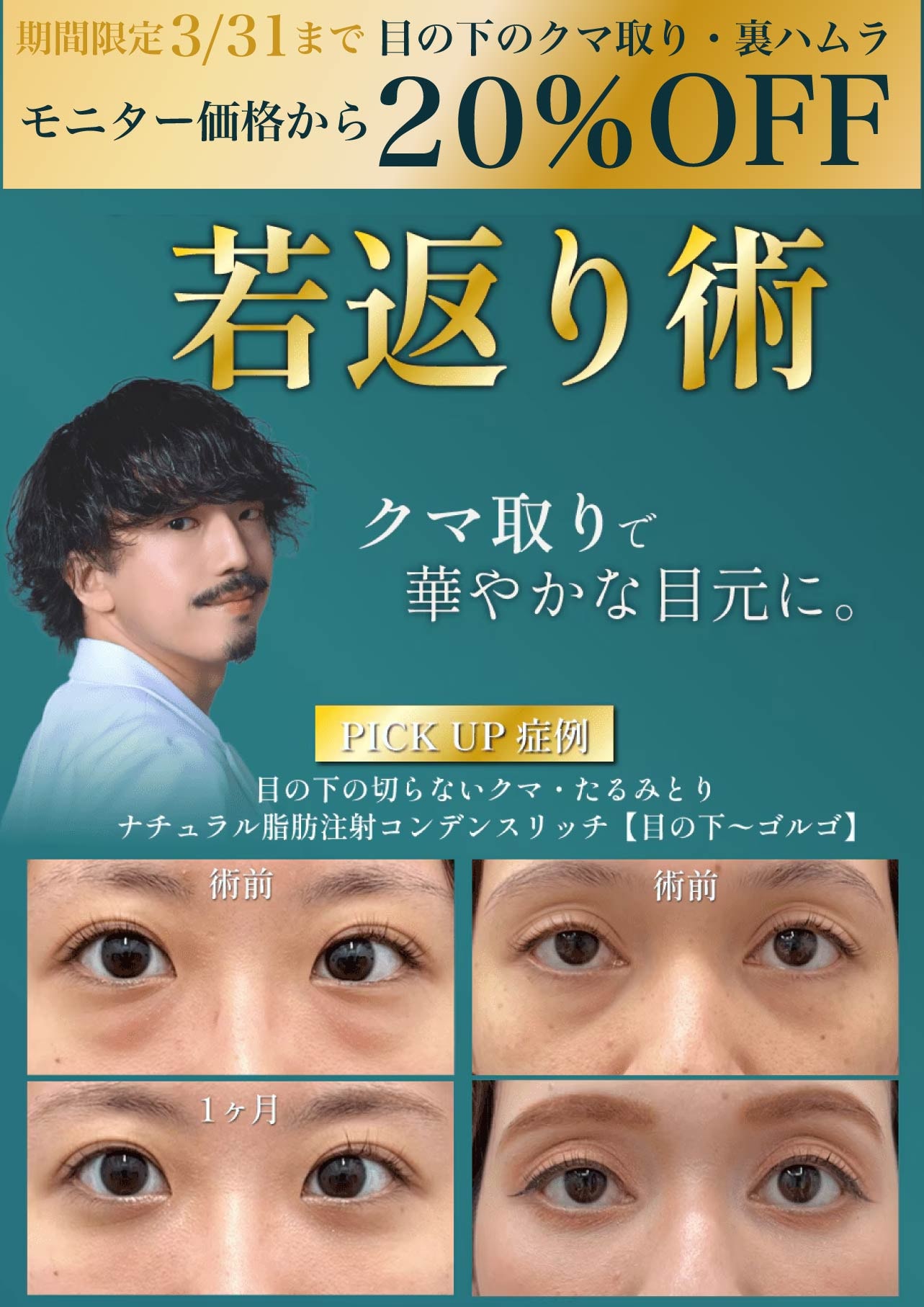 【今なら20％OFF】【耳鼻咽喉・頭頸部外科出身】オーダーメイドのクマ治療で圧倒的な若返りを実現いたします！