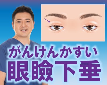 【切らない眼瞼下垂で関東No.1】川崎院院長、伊藤のりが人気な理由✨必見です！