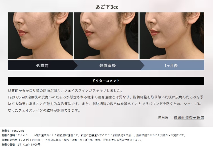 ファットエックス コアはどんな方におすすめ?