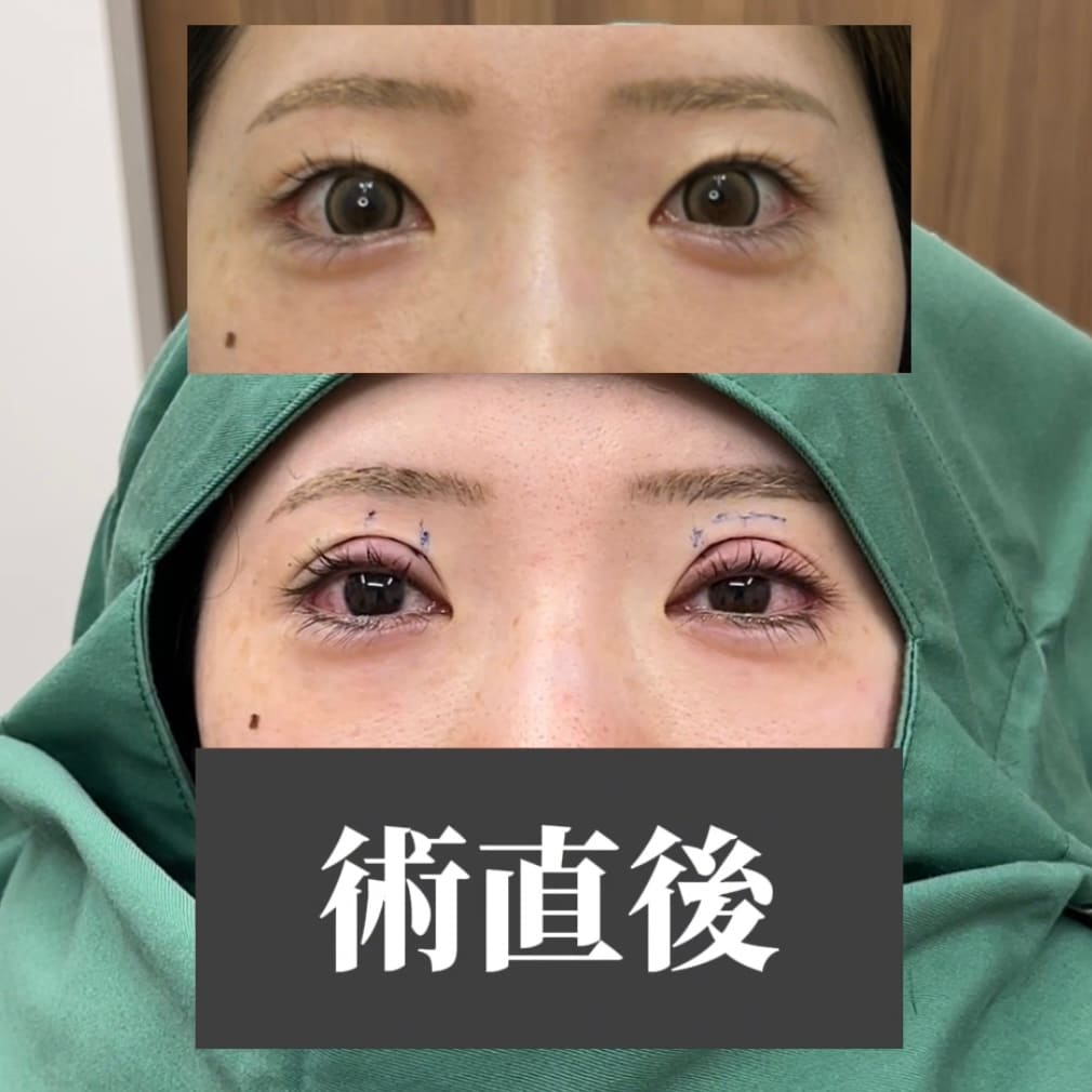 術直後の様子