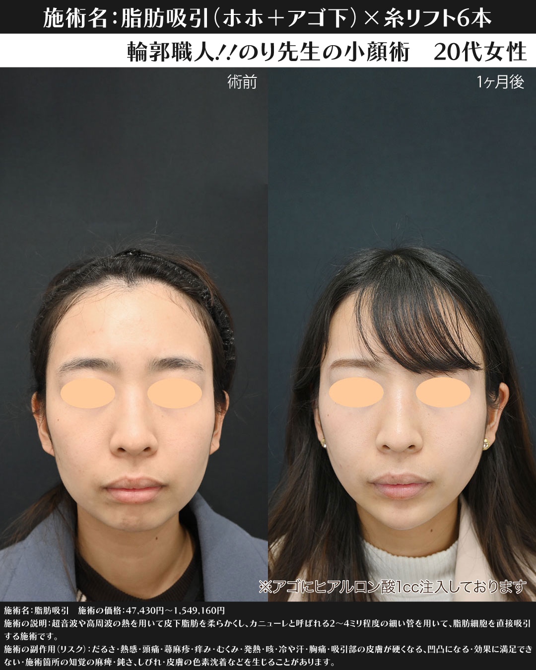 20代女性