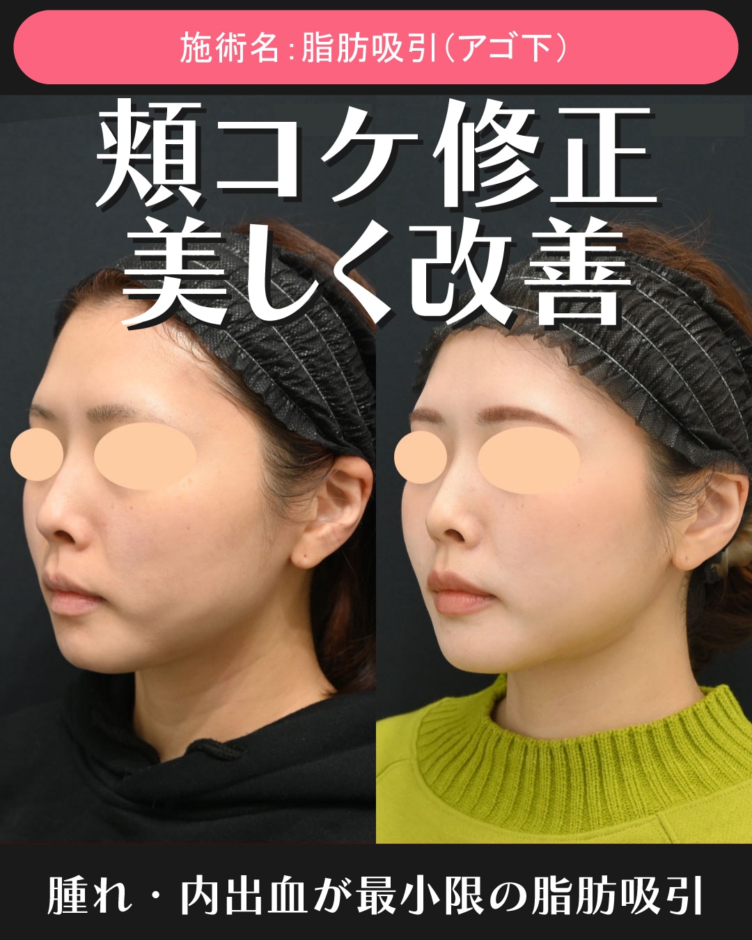 他院修正も得意