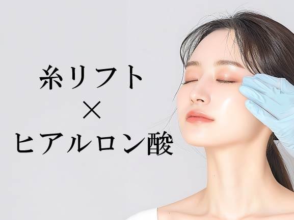 糸リフト×ヒアルロン酸注入
