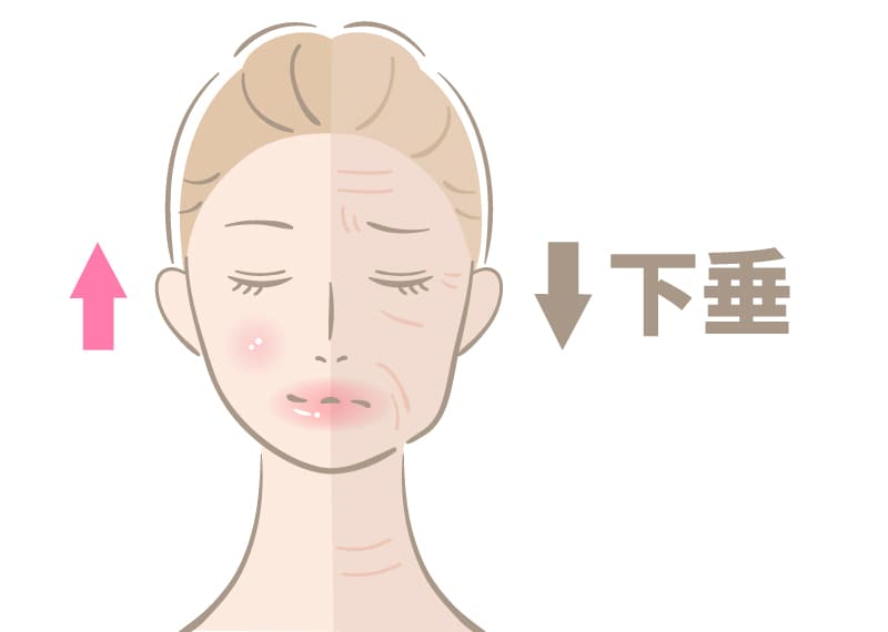 原因①:顔の脂肪の減少・移動(下垂)