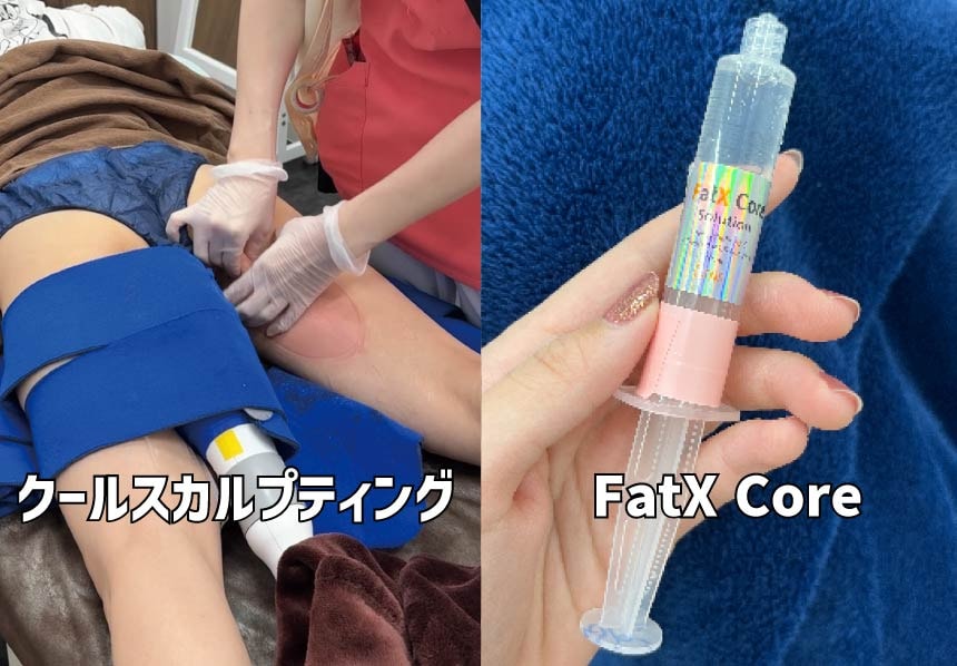 脂肪溶解注射と脂肪冷却どちらが良い？