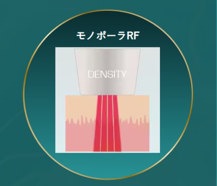 モノポーラRF(深部作用)とは?