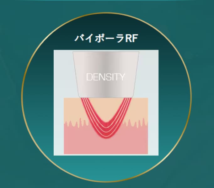 バイポーラRF(表層作用)とは?