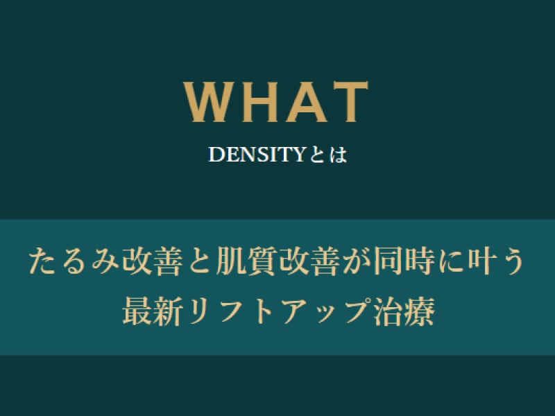 デンシティの強み