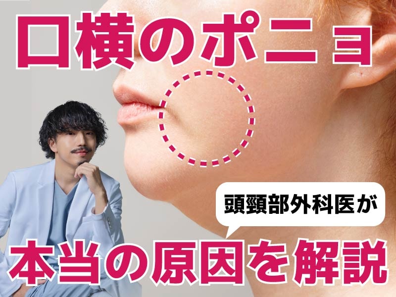 【頭頸部外科医が解説】口横のポニョの原因はジョールファットだけじゃなかった？意外な原因を徹底解説します✨