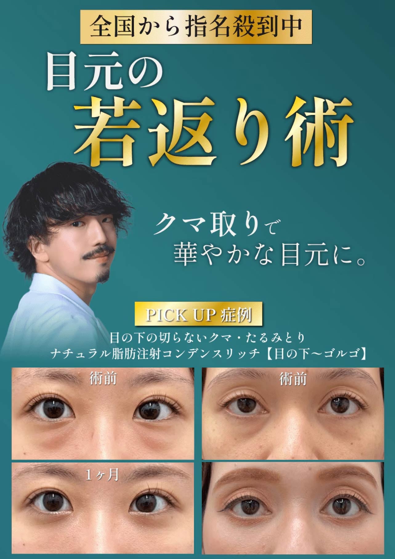クマ取りならお任せください✨