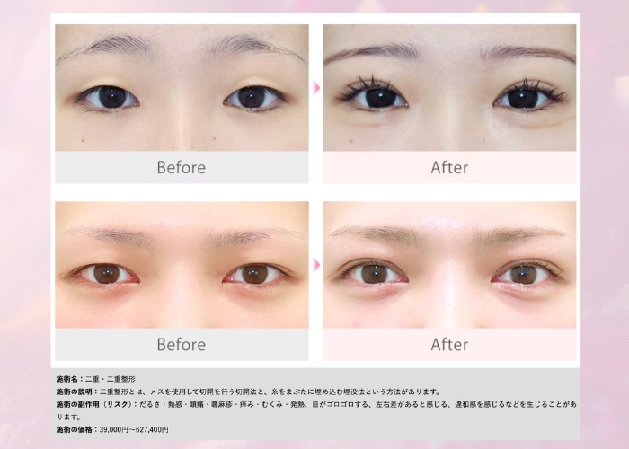 形成外科専門医の繊細な技術