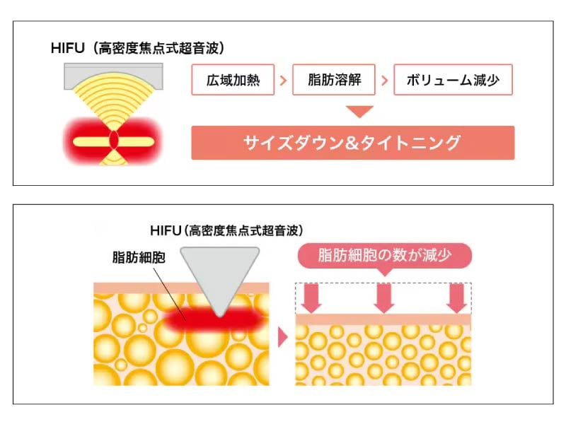「脂肪を溶かす」仕組みを徹底解説