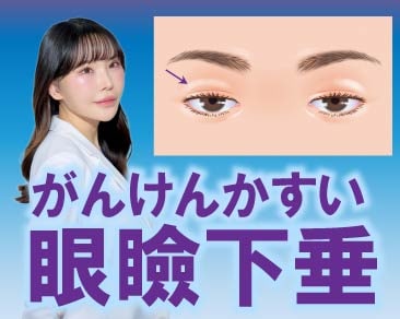 【まぶたが重い・下がる方へ】切らない眼瞼下垂でデカ目に!ダウンタイム最小限の最新治療を紹介します✨