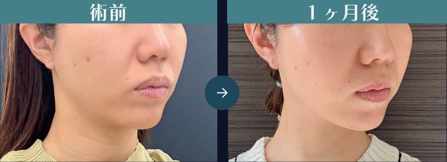 いつから実感できる？