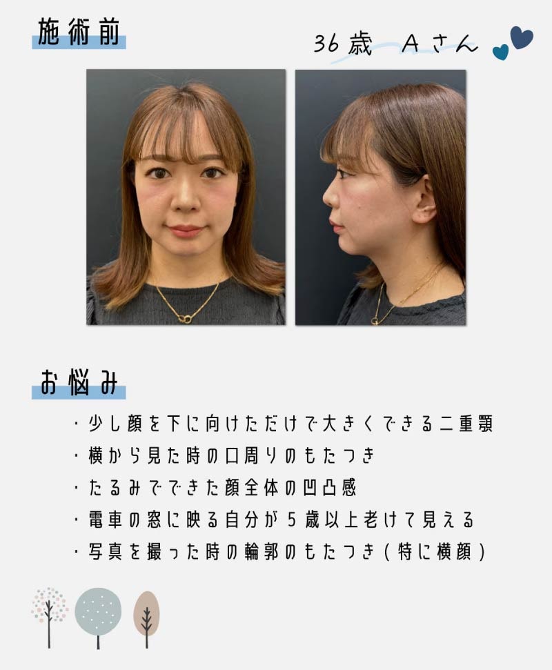 《ミドル世代３６歳》施術前写真＆お悩み