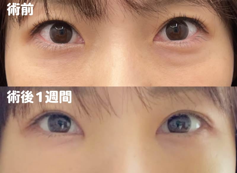 ビフォーアフター