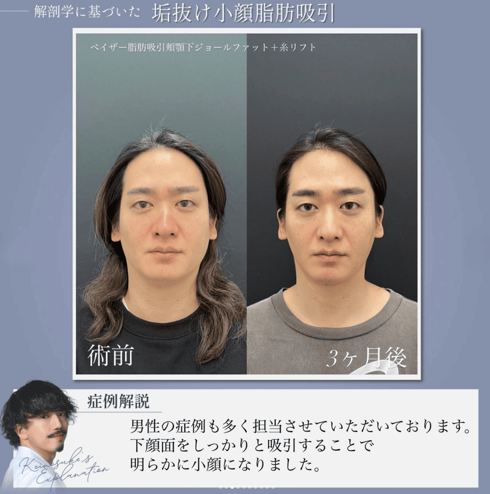 📢 速報！ 小顔整形・脂肪吸引の「名医」が川崎院へ！