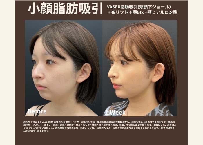 3. 驚きの仕上がり！わずか1週間でこの変化✨