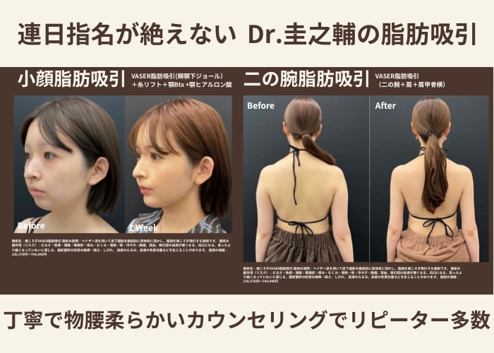 🚨 連日指名が絶えません！佐藤院長を指名するには？