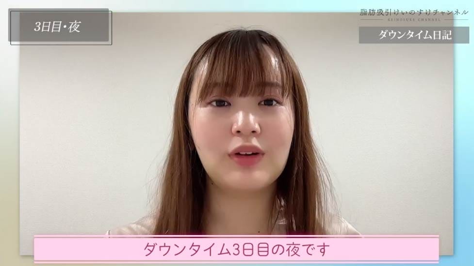 術後3日目：むくみが広がる時期