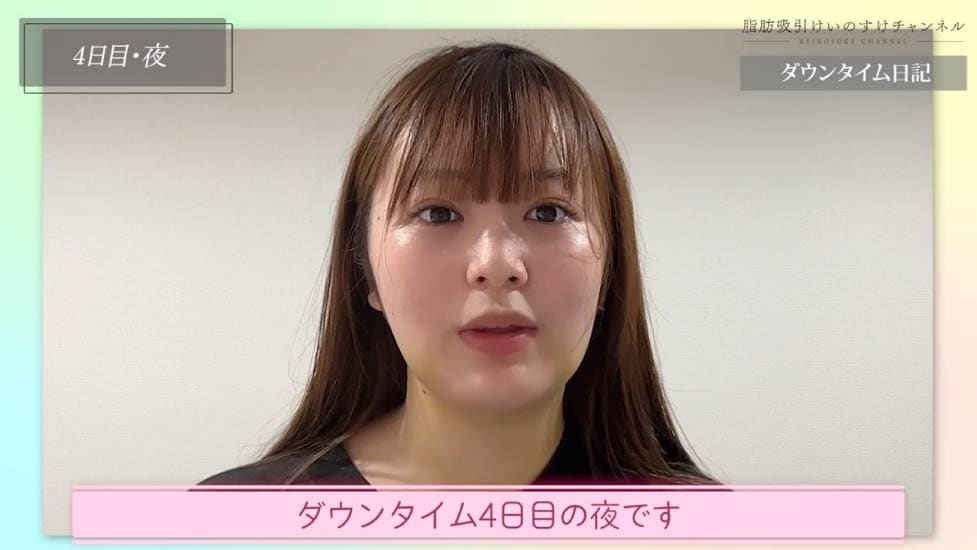 術後4日目：スッキリし始める「変化の日」