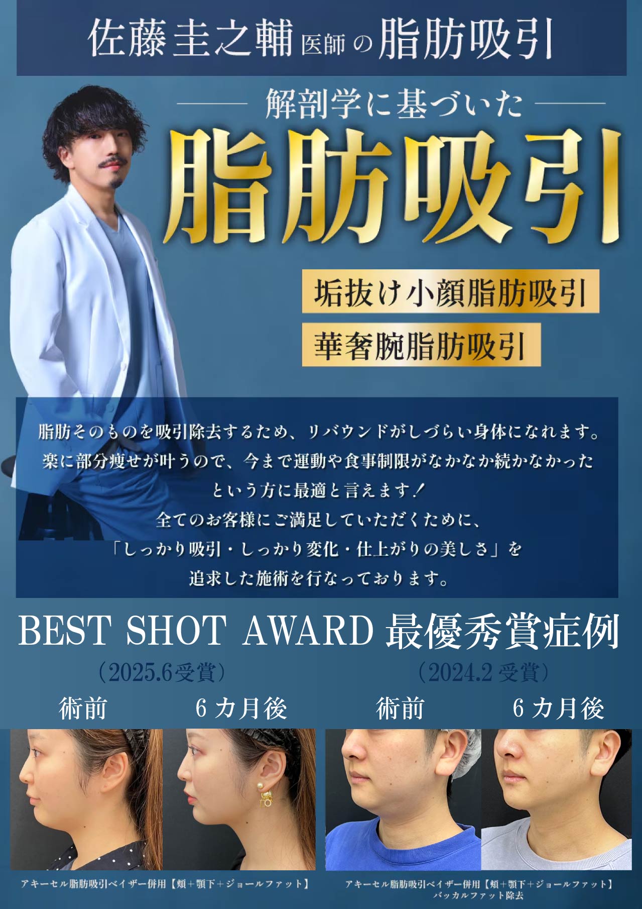 【脂肪吸引】全国3位の症例数（2024年上半期SBC内ランキング）