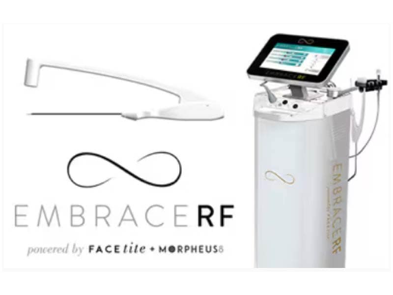 エンブレイスって何？