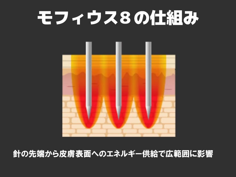 モフィウス8の仕組み