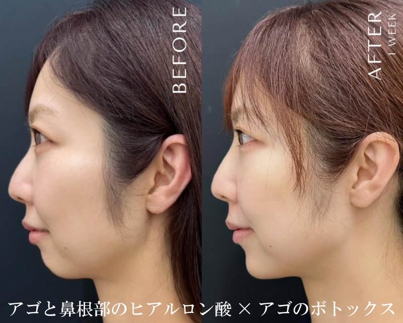 外科だけでなく注入治療も得意