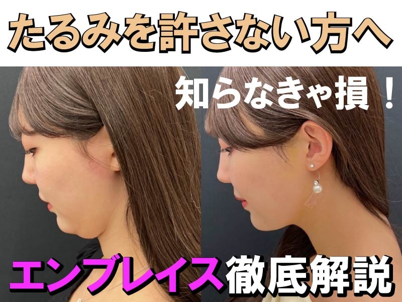 【エンブレイス完全解説】脂肪吸引で失敗しないために…術後のたるみを軽減する方法を徹底解説✨