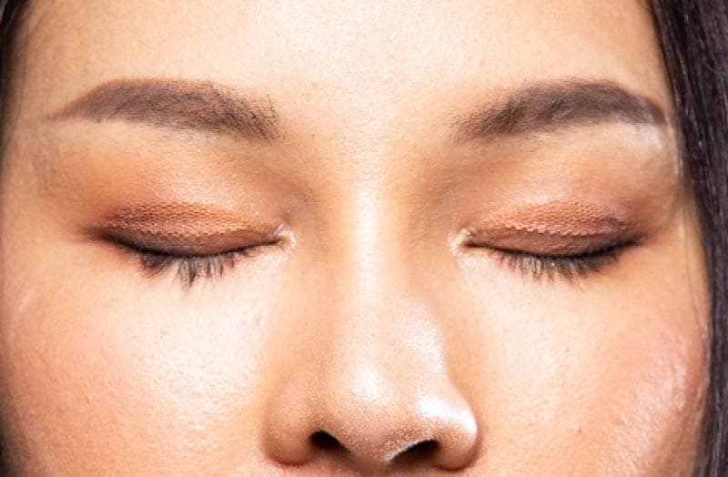 なぜ眼瞼下垂になるの？