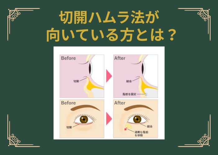 切開ハムラが向いている方