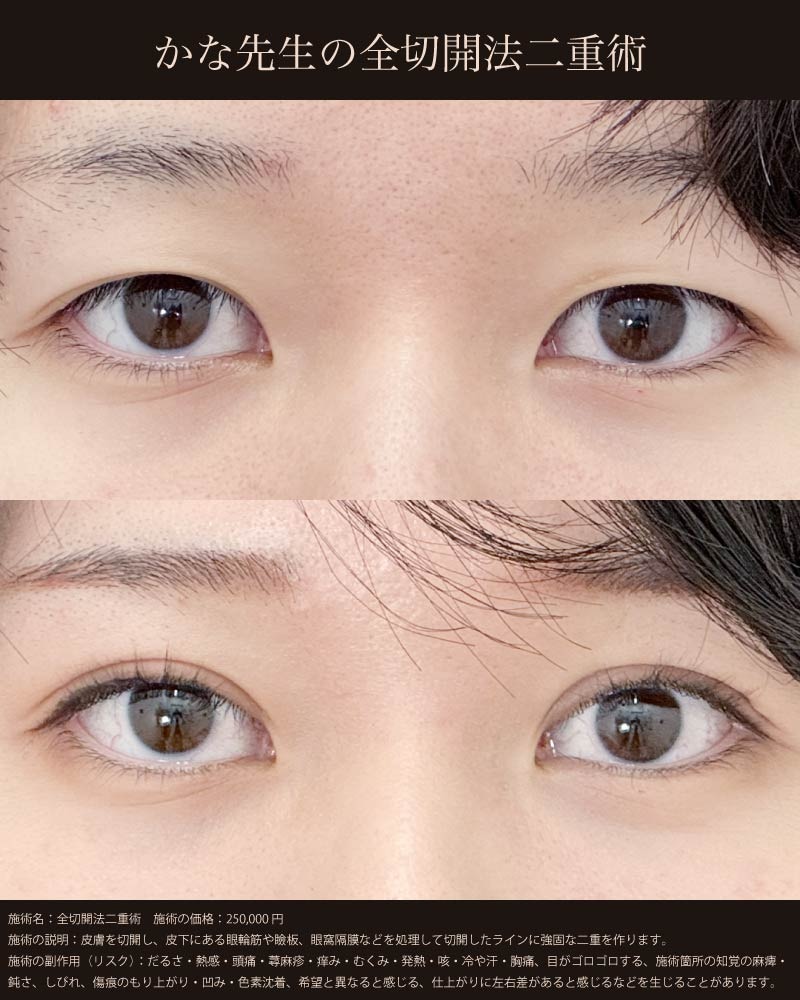 半永久的でくっきりしたライン