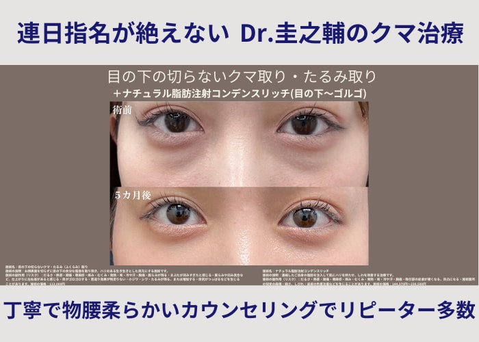 目の下のクマは「1つの治療」で解決する悩みではありません