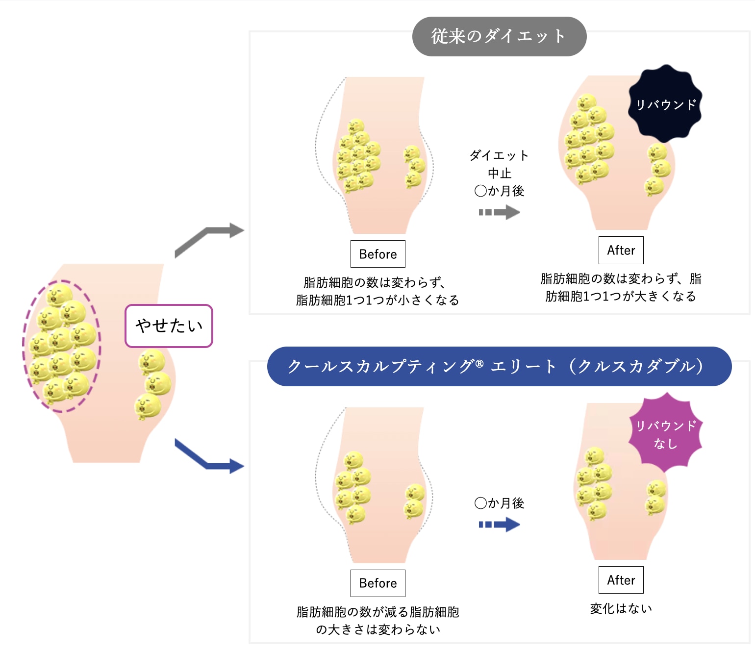 クールスカルプティングって何？