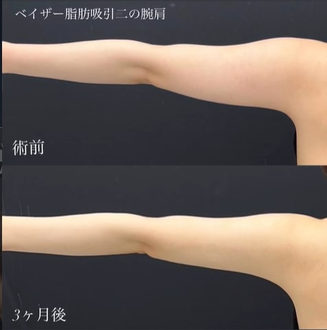 まず症例をご覧ください