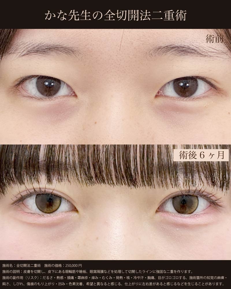 将来まで続く「自然な美しさ」