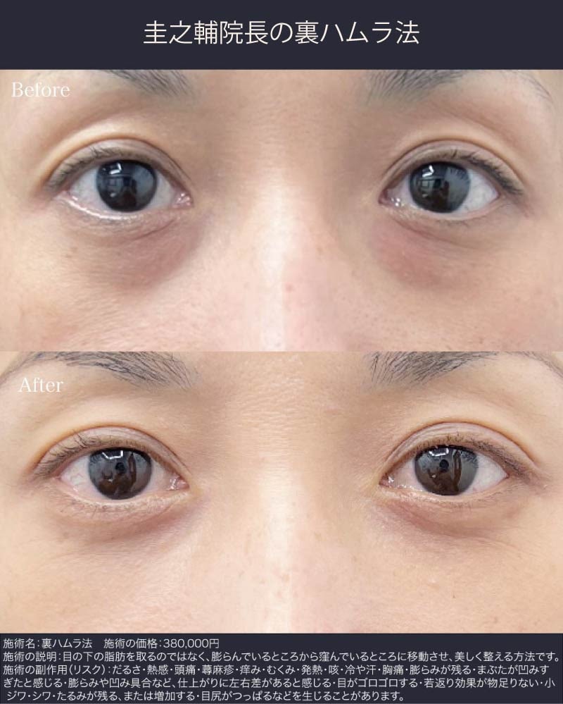 【裏ハムラが向いている方】