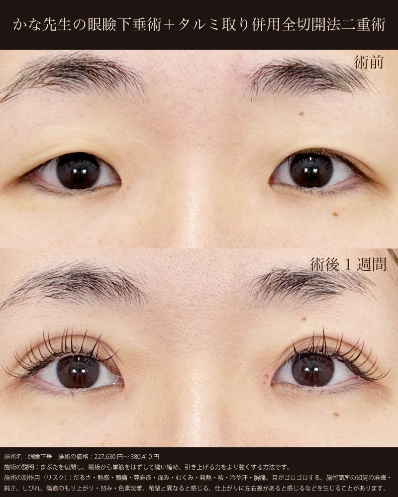 皮膚を整え「明るい目元」へ