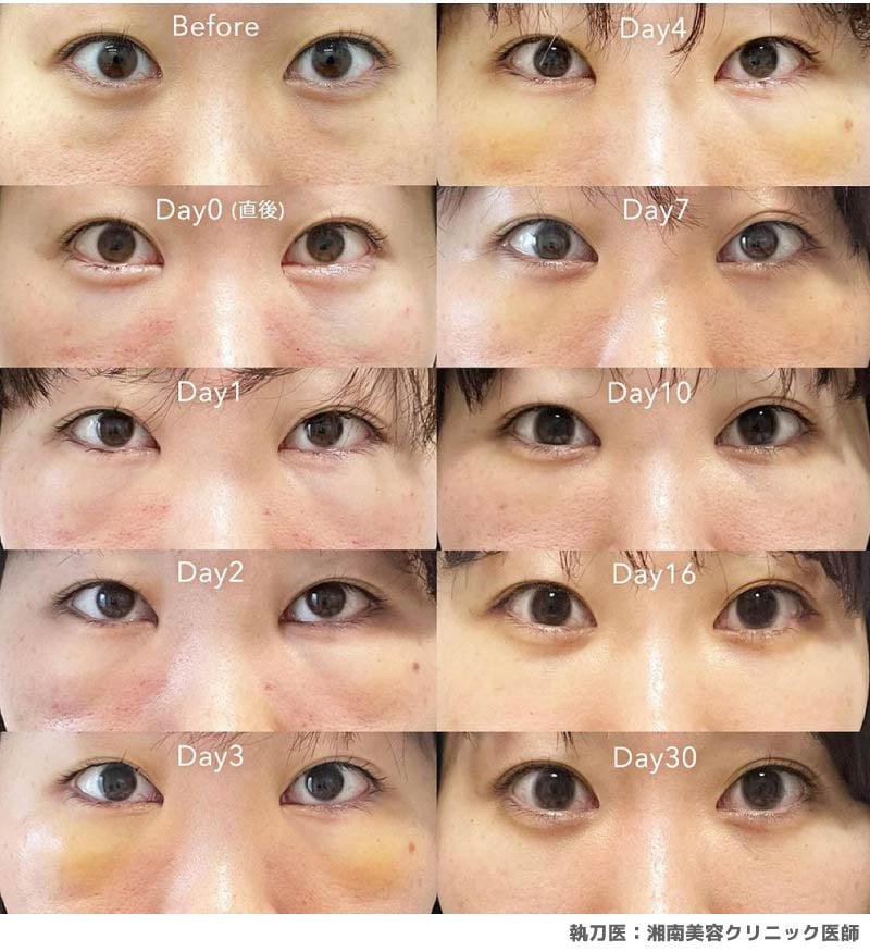 Q. どれくらいで完成？