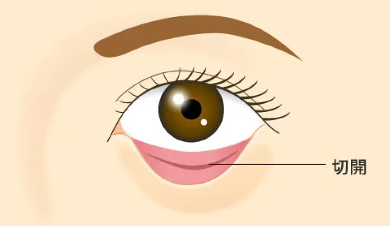 Q. 傷は見えますか？