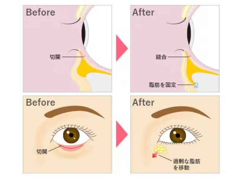Q. 脱脂と何が違うの？