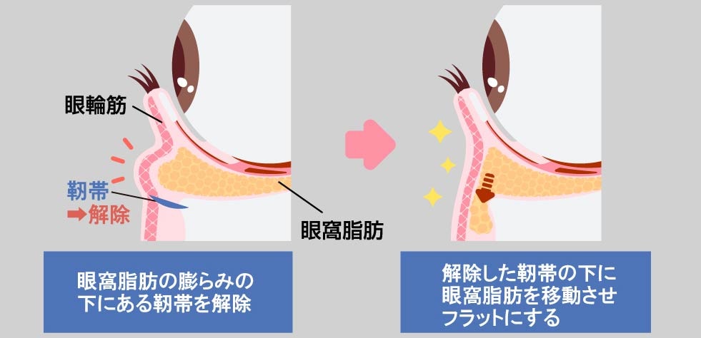 「脱脂だけ」では不十分なんです💦