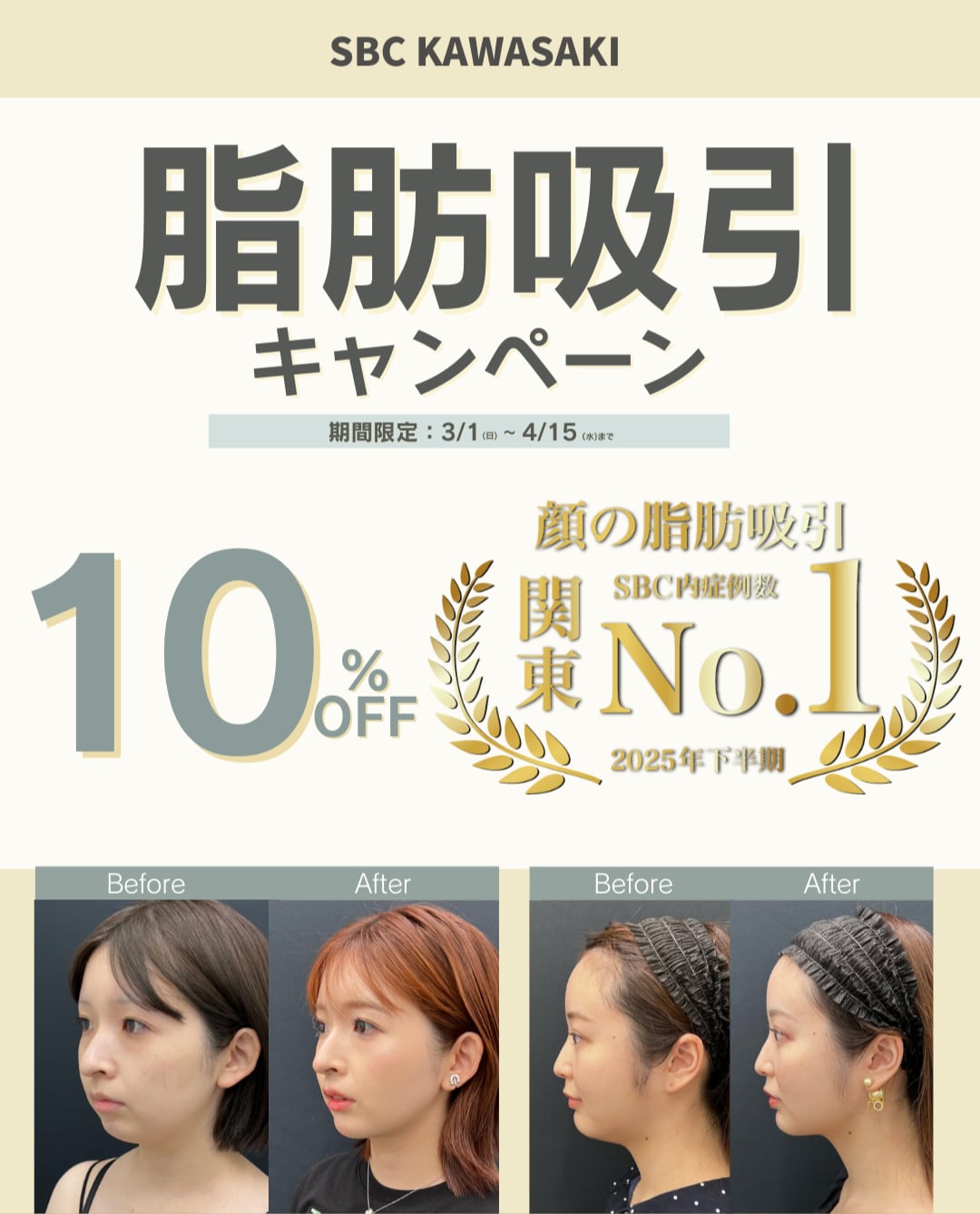 3/1〜脂肪吸引キャンペーン開始！✨