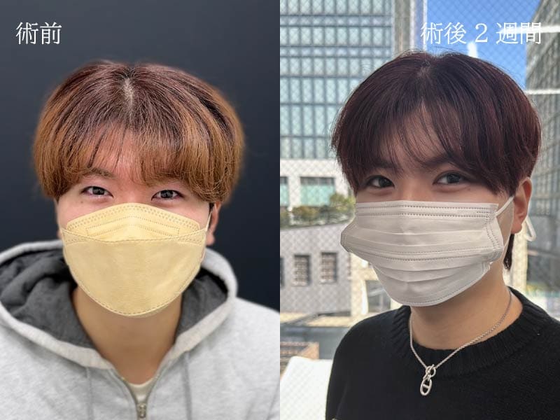 「10年後、20年後もこの瞳で良かったと思ってほしい」