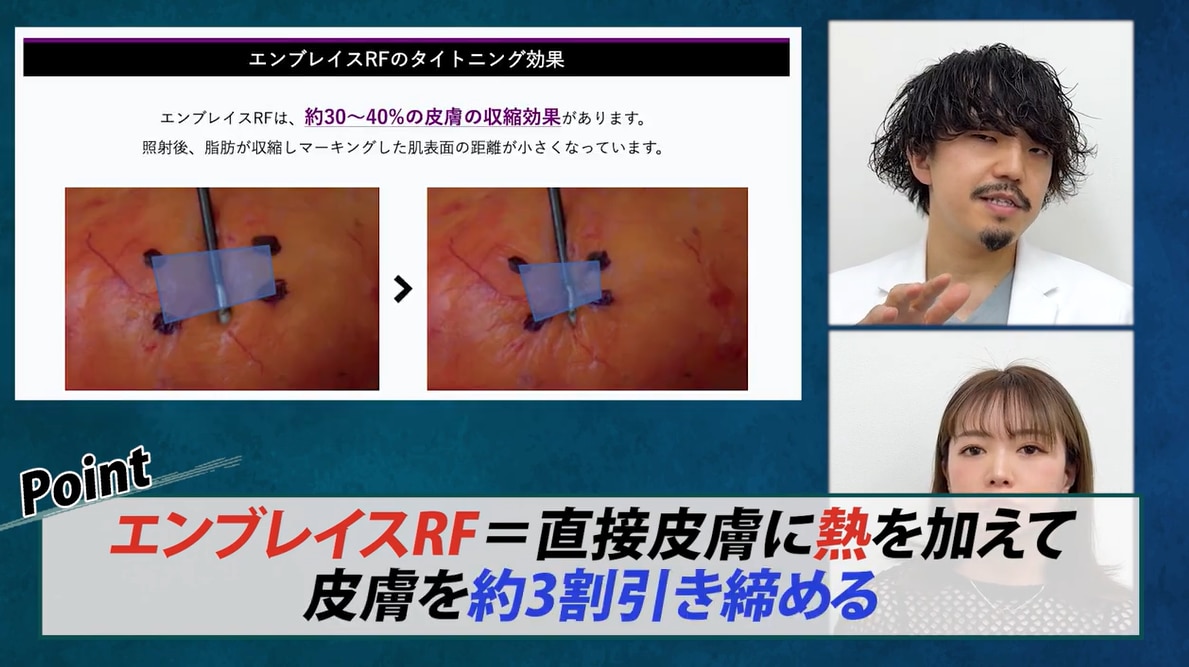 佐藤院長の真骨頂「脂肪吸引×エンブレイスRF」による引き締め