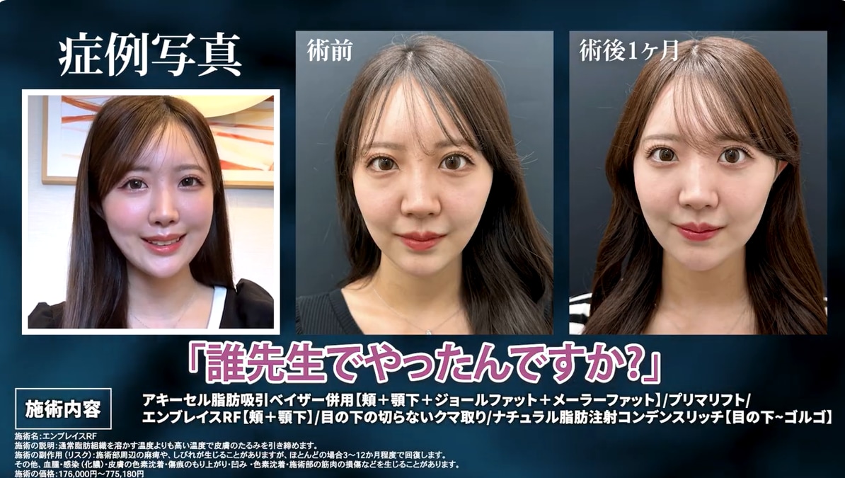 「どこの先生でやったの？」と聞かれる圧倒的な変化