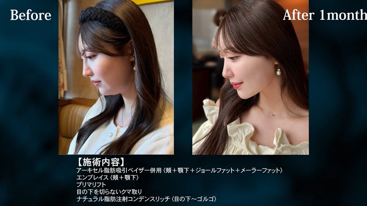 コンプレックスを自信に変える圭之輔院長の技術