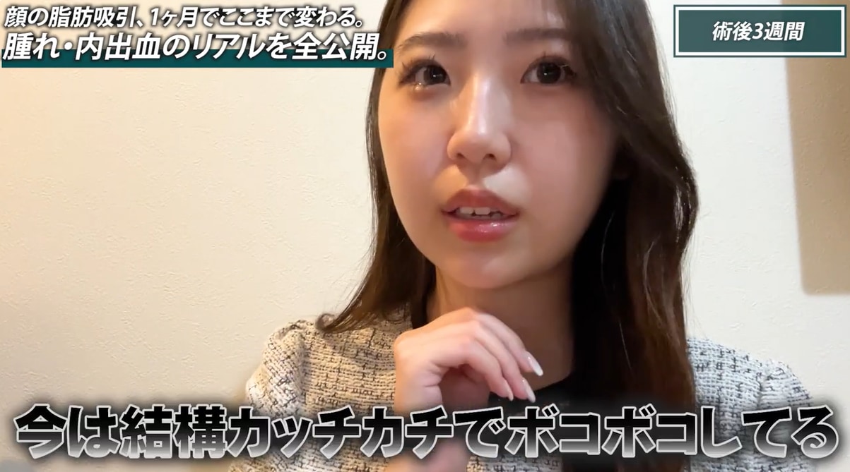 2週間〜3週間目：皮膚がカチカチ！？拘縮との戦い