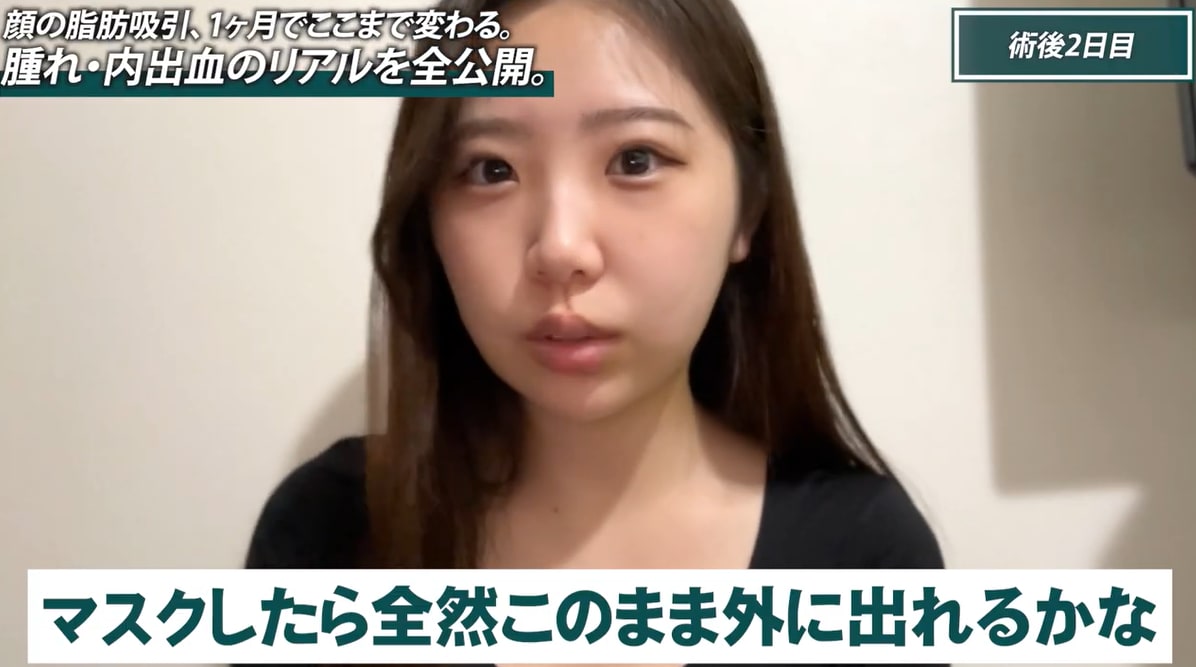 Q. 仕事でバレる可能性はある？